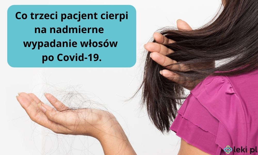 30% pacjentów cierpi na nadmierne wypadanie włosów po Covid-19.