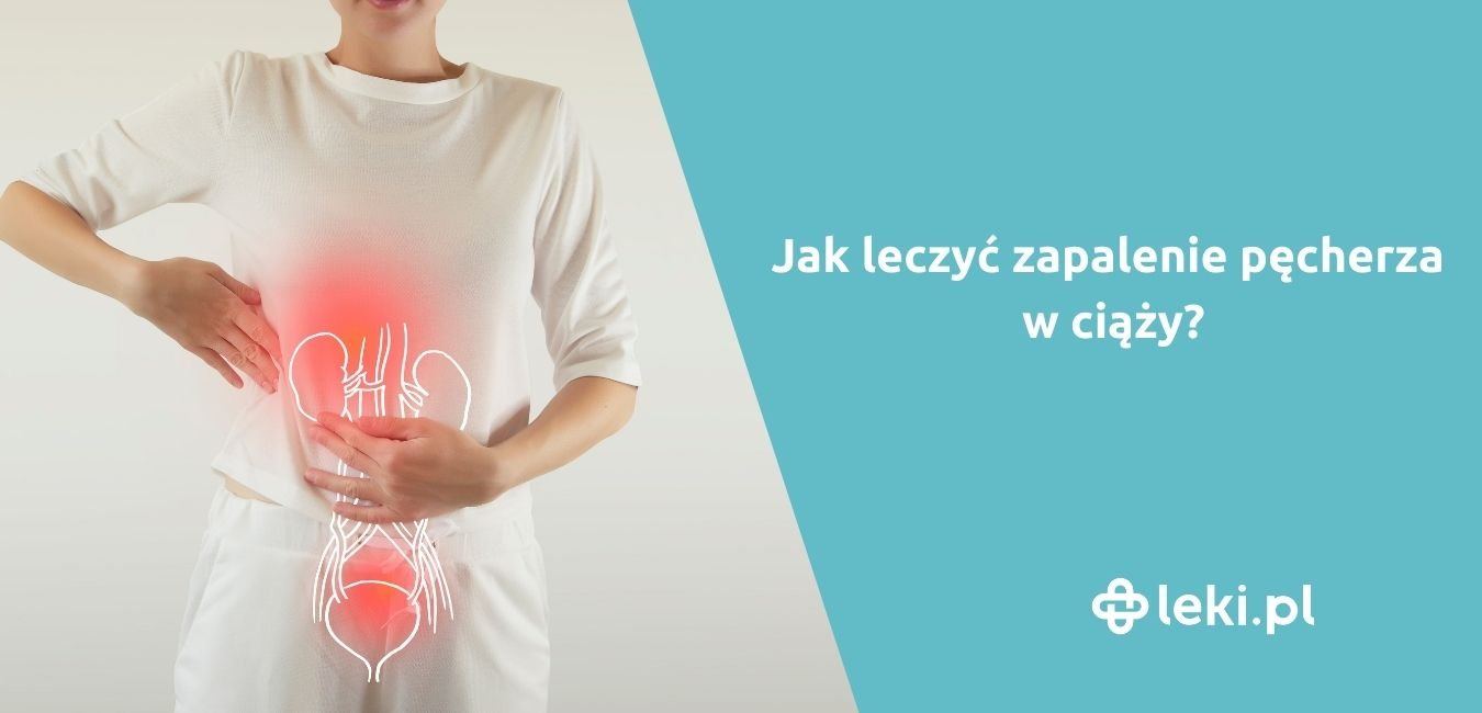 Jak leczyć zapalenie pęcherza w ciąży?