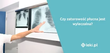 Ilustracja poradnika Zatorowość płucna – postępowanie i leczenie