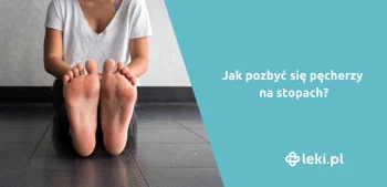 Ilustracja poradnika Pęcherze na stopach — jak im zapobiec i jak je leczyć?