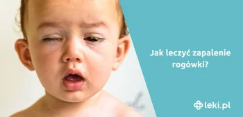 Ilustracja poradnika Zapalenie rogówki – ile trwa i jak je leczyć?