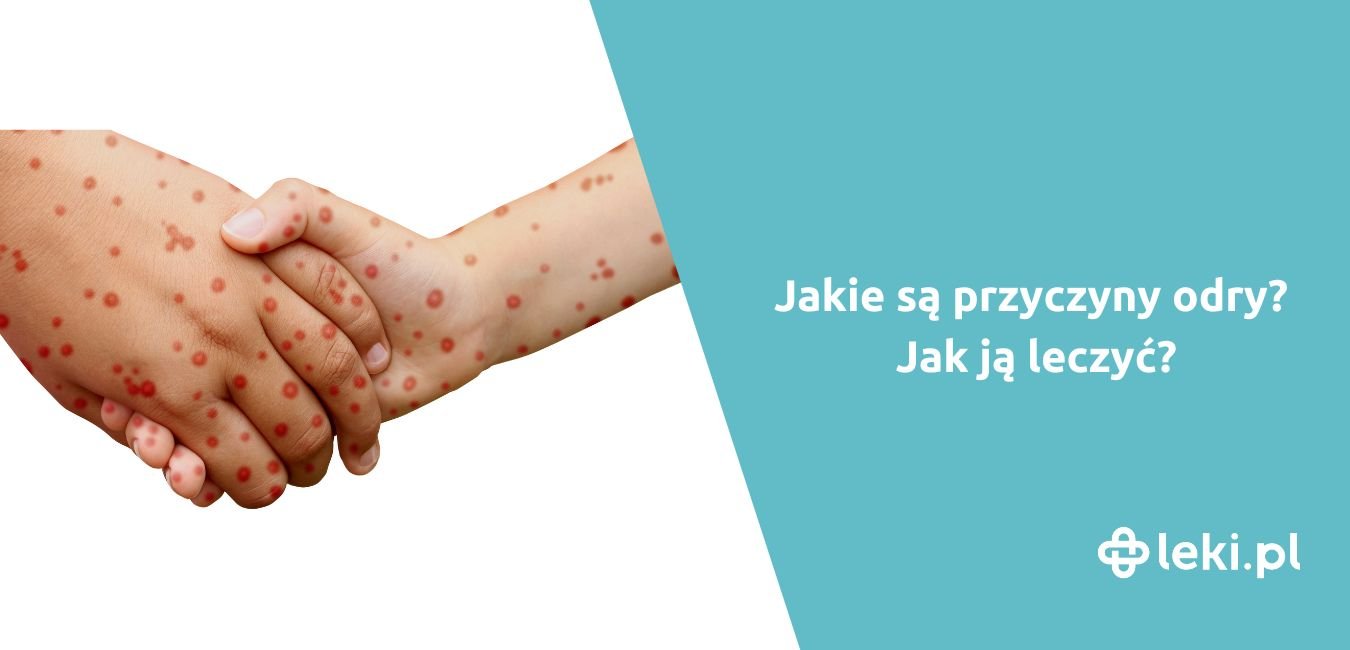 Odra – jak można się nią zarazić?