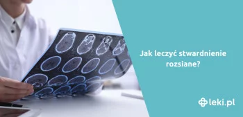 Ilustracja poradnika Rewolucja w leczeniu stwardnienia rozsianego. Jak je leczyć?