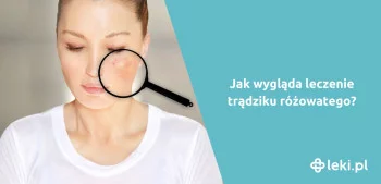 Ilustracja poradnika Jakie są skuteczne leki na trądzik różowaty?