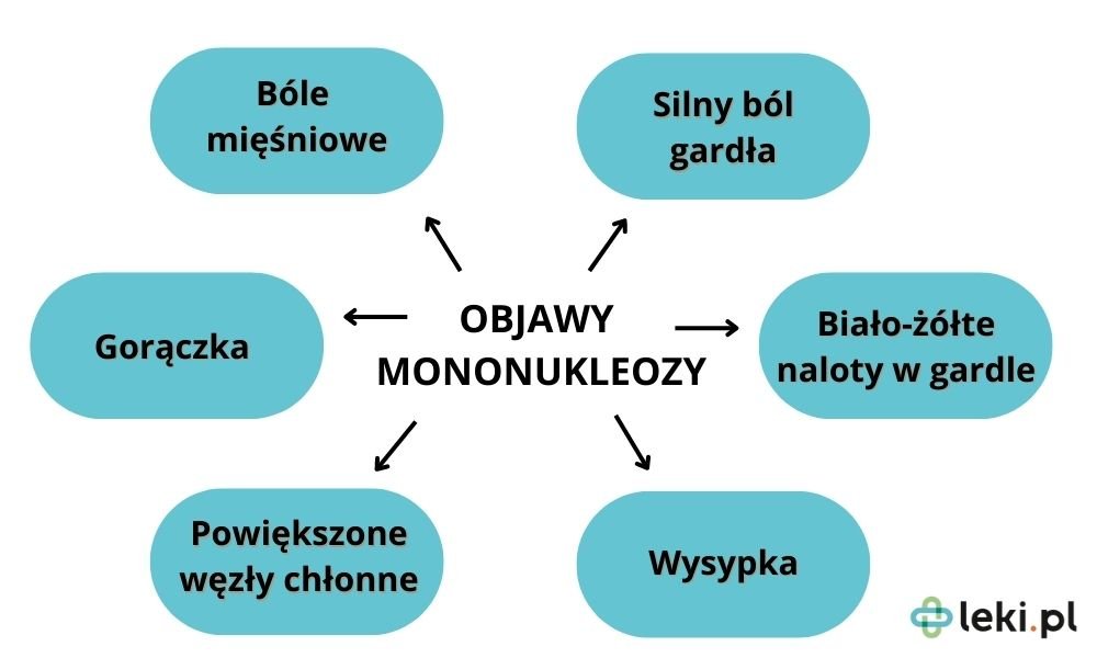 Jakie są objawy mononukleozy?