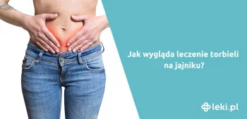 Ilustracja poradnika Jak wygląda leczenie hormonalne torbieli na jajniku?