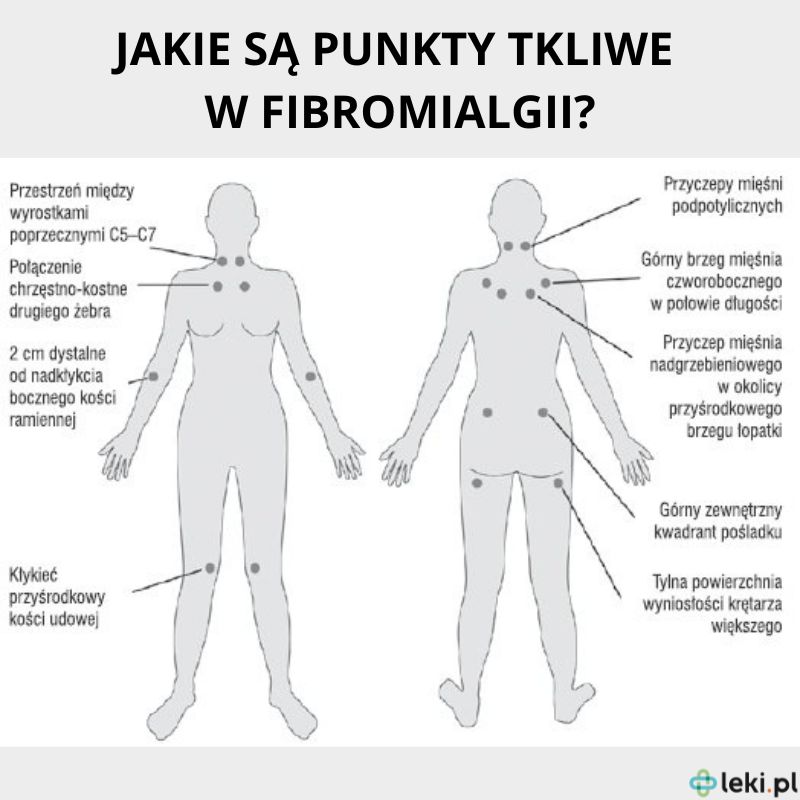 Jakie są punkty tkliwe z fibromialgii?