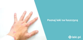 Ilustracja poradnika Jakie leki biologiczne są stosowane na łuszczycę?