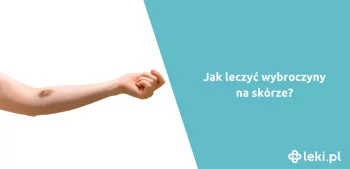 Ilustracja poradnika Jak wyglądają wybroczyny na skórze?