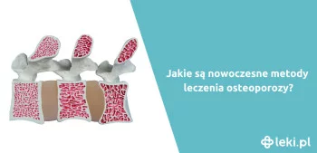 Ilustracja poradnika Jak wygląda nowoczesne leczenie osteoporozy?