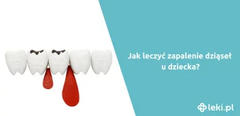 Ilustracja poradnika Jak leczyć zapalenie dziąseł u dziecka?