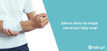 Ilustracja poradnika Zdarta skóra do mięsa – jak leczyć taką ranę?