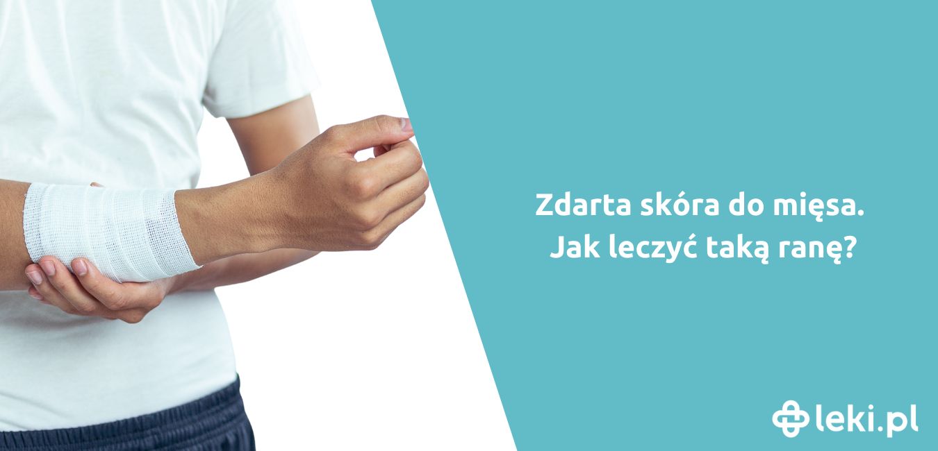 Zdarta skóra do mięsa – jak leczyć taką ranę?