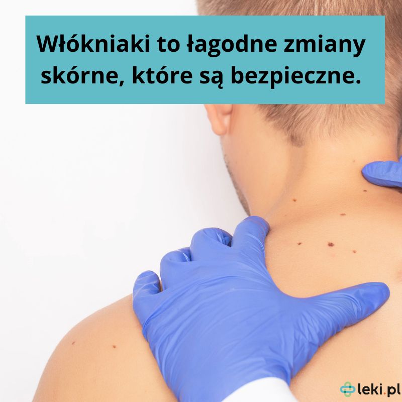 Czy włókniaki są niebezpieczne? 