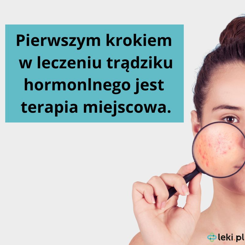 Leczenie trądziku hormonalnego.