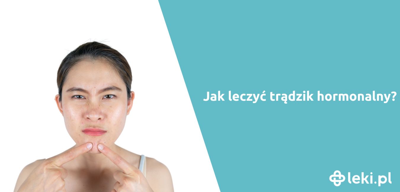 Jak leczyć trądzik hormonalny?