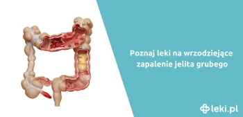 Ilustracja poradnika Jakie są nowe leki na wrzodziejące zapalenie jelita grubego?