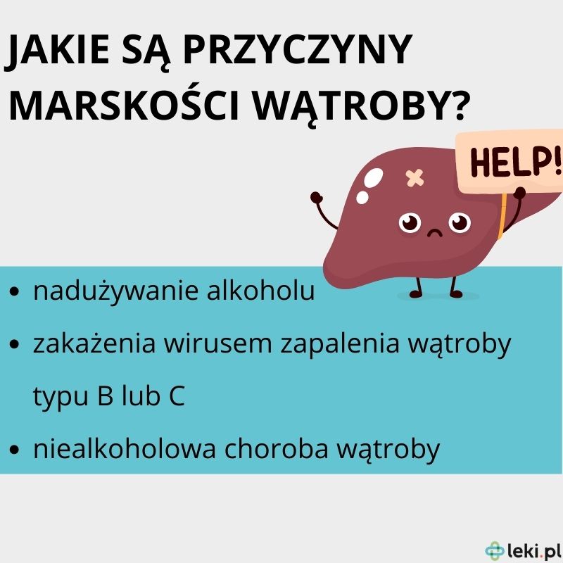 Przyczyny marskości wątroby.