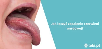 Ilustracja poradnika Czym jest zapalenie czerwieni wargowej?