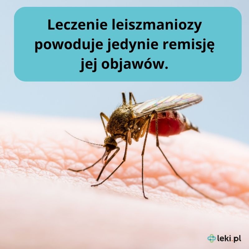 Jak wygląda leczenie leiszmaniozy? 