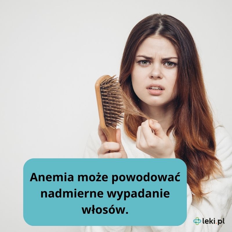 Anemia a wypadanie włosów. 