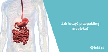 Ilustracja poradnika Jakie są objawy przepukliny przełyku?