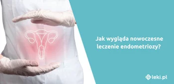 Ilustracja poradnika Jakie są nowe leki na endometriozę?